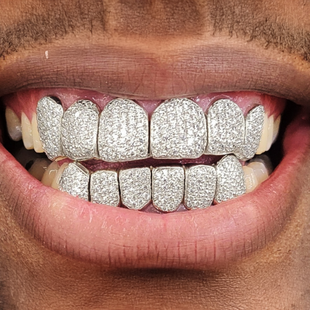 white gold grill moissanite