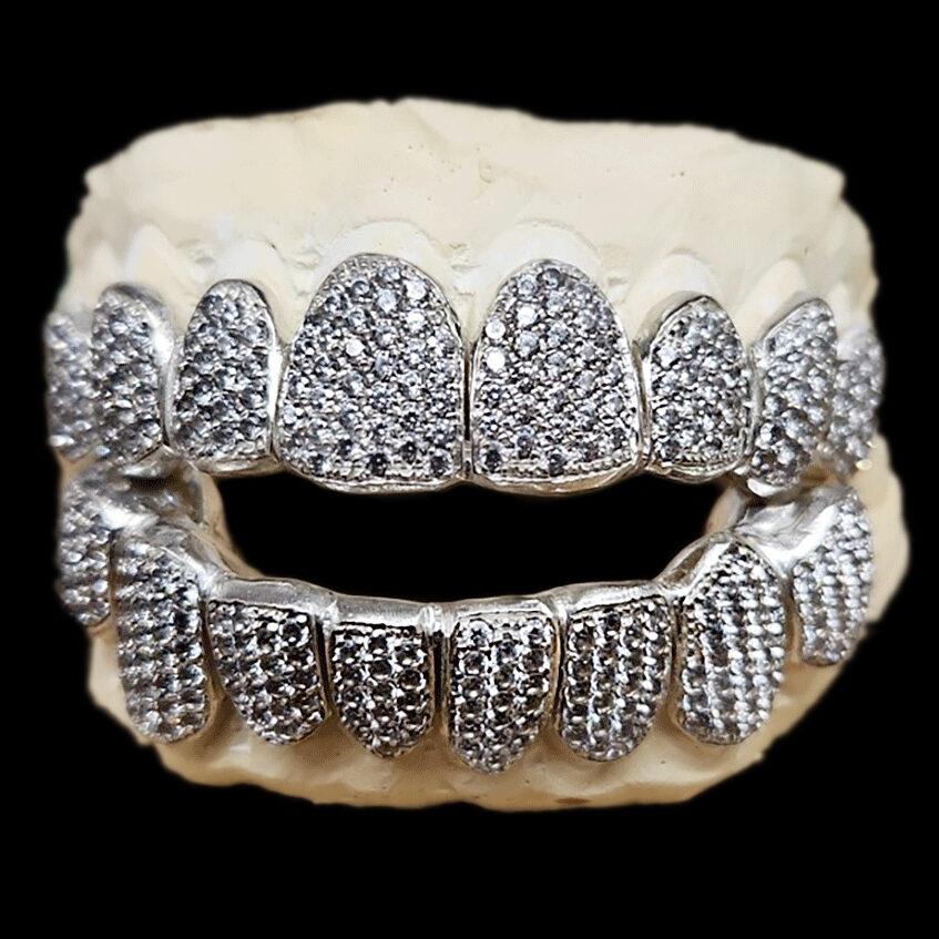 White gold grill with diamonds