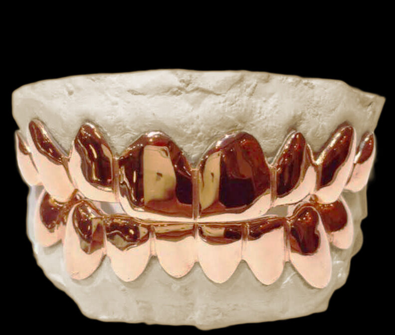 rose gold grillz perm cut