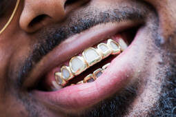open face gold grillz